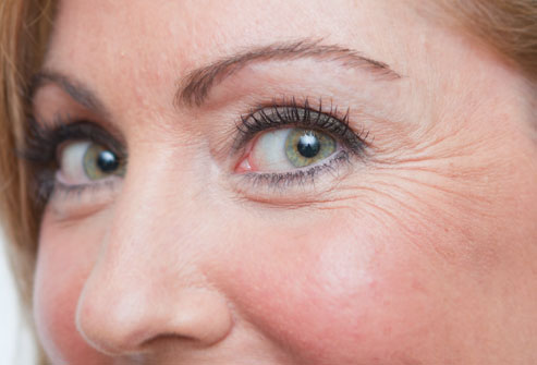 Botox and Fillers in Lahore Pakistan
