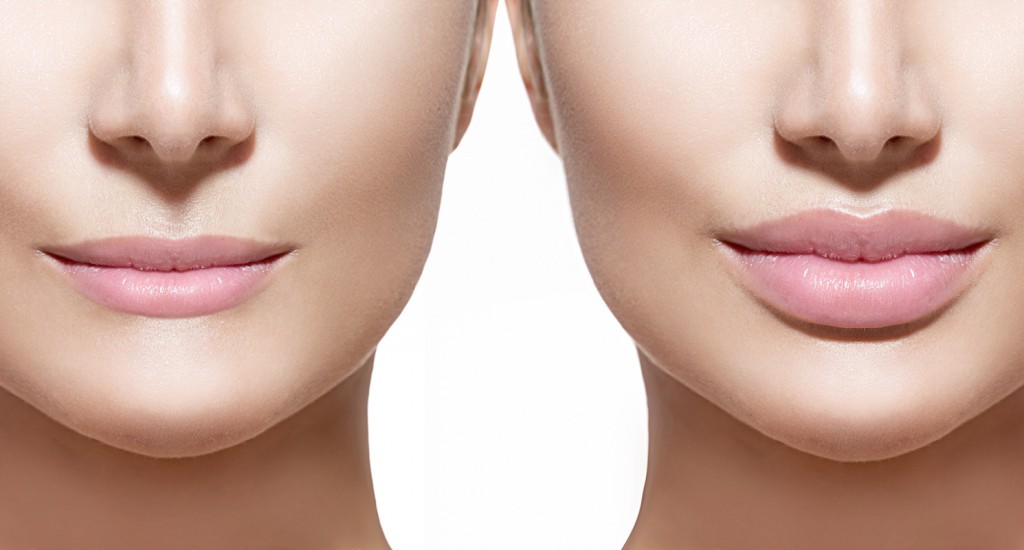 Botox and Fillers in Lahore Pakistan