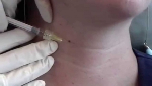 Botox and Fillers in Lahore Pakistan