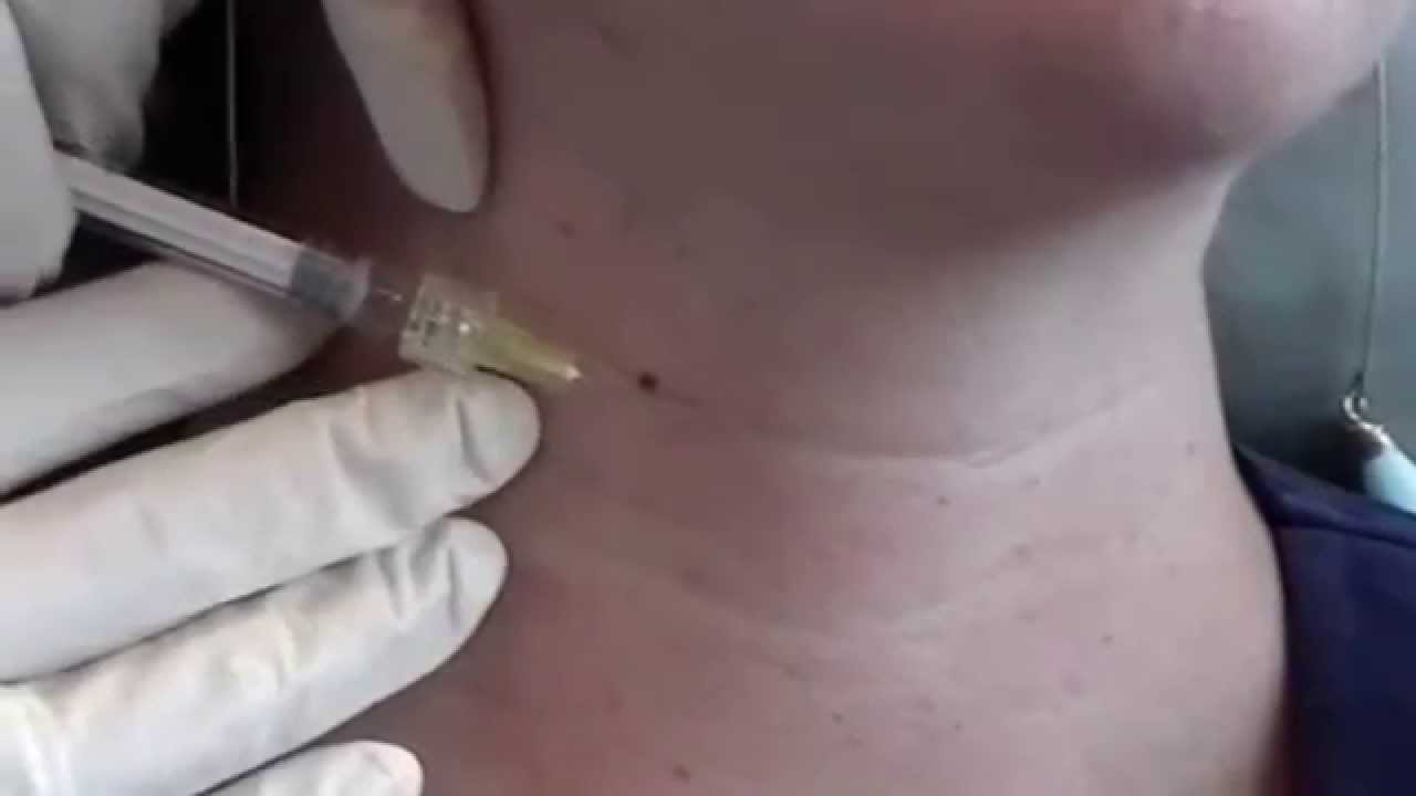 Botox and Fillers Lahore Pakistan