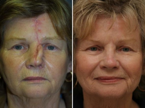reconstructive surgery worcester