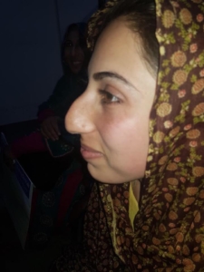 Rhinoplasty