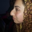 Rhinoplasty