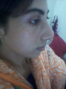 Rhinoplasty