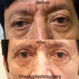 Dr Sheraz Raza
